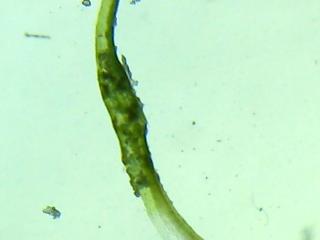 BTax245.Ex2.Img1.jpg-RefImg