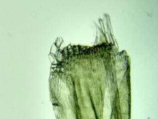 BTax664.Ex1.Img5.jpg-RefImg