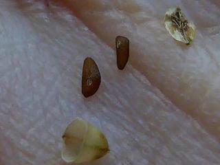 Img.VTax2804.ExN.Img4