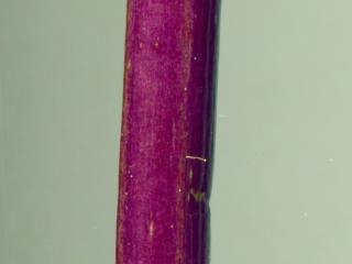 Img.VTax2868.ExN.Img11