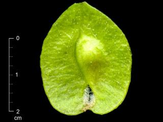 Img.VTax1698.ExN.Img11