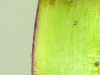 Img.VTax3343.ExN.Img4