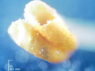 Img.VTax2140.Ex3.Img1