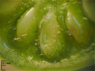 Img.VTax2567.Ex2.Img6