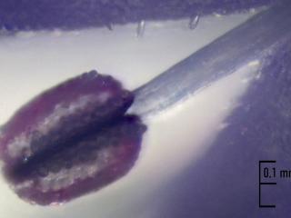 Img.VTax2808.Ex3.Img13