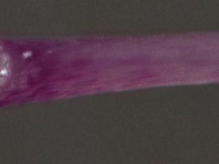 Img.VTax4456.Ex1.Img3