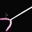 Img.VTax2303.Ex2.Img3