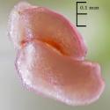 Img.VTax516.Ex2.Img1